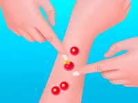 https://www.y8gamesx.com/game/pimple-poper-rush