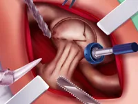 https://www.y8gamesx.com/game/princess-hips-surgery